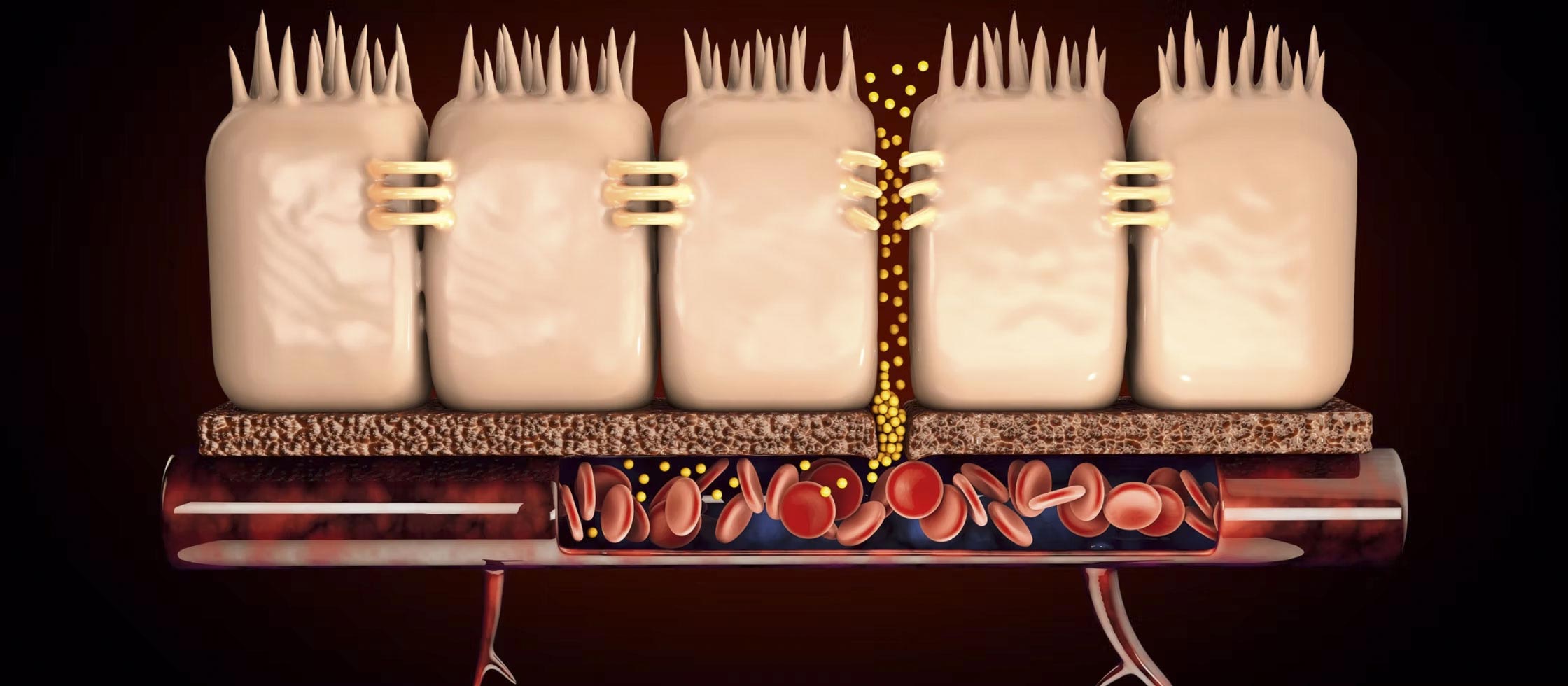 Leaky Gut Syndrome